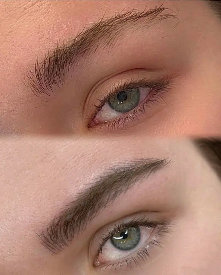 Antes y despues de microblanding